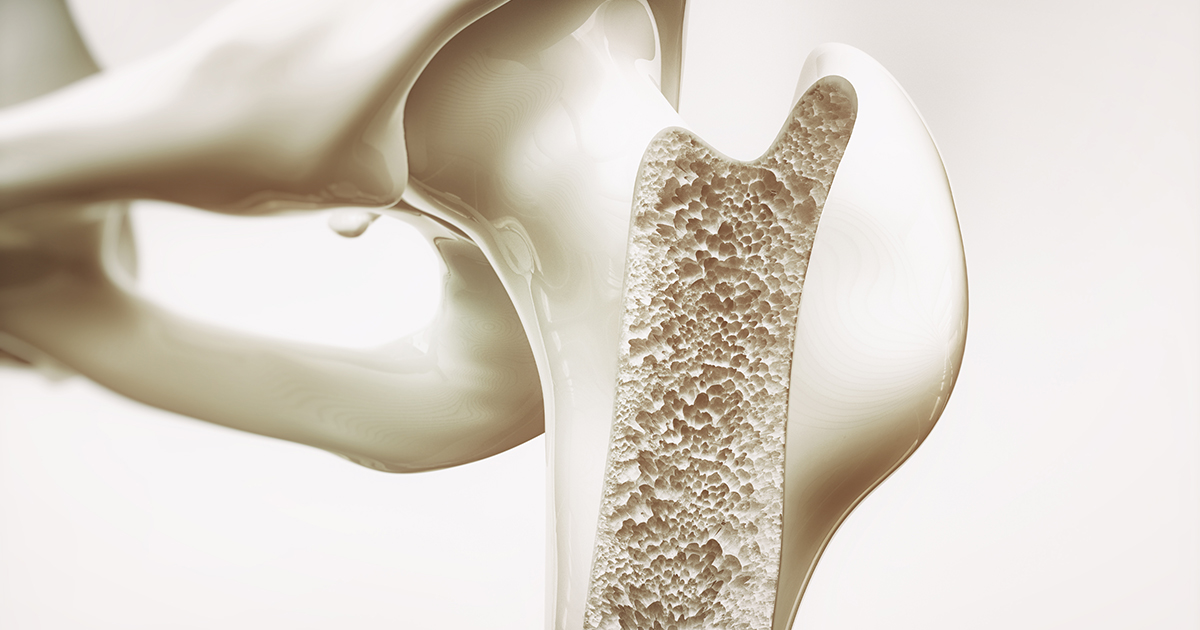 Scientists develop mineralized DNA hydrogel to accelerate bone repair Scientists develop mineralized DNA hydrogel to accelerate bone repair